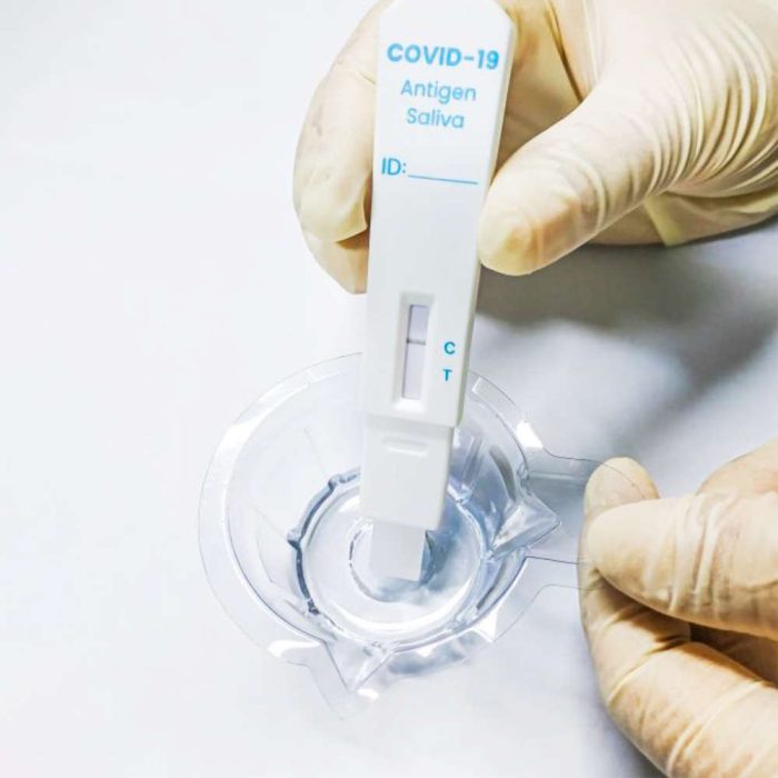 WISETEST JSJ Saliva SARS-CoV-2 (2019-nCoV) Antigen Test Kit (NanocarbonAssay)